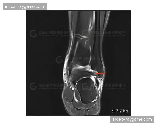 官方:里昂中场卡克雷因脚踝韧带损伤将缺席六周 官方:里昂中场卡克雷因脚踝韧带损伤将缺席六周